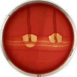Rhodococcus Equine Plasma